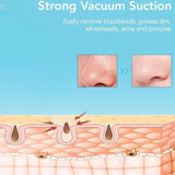 Rechargeable Blackhead Remover Vacuum Cleaner | Model FPLS-001 | Deep Pore Cleansing & Microdermabrasion Device