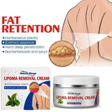 Lipoma Removal Cream | Herbal Skin Care Cream for Smooth & Nourished Skin | Fast-Absorbing Formula | For Neck & Body | 50g