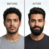 Dr. Alies Professional Beard Growth Oil | Natural Beard Care Oil for Patchy & Thin Beards | Moisturizing, Itch & Dandruff Care | 30ml