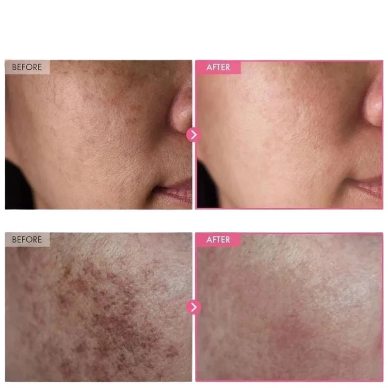 Arbutin 7% + Tranexamic Acid 4% Cream | Brightening Moisturizer for Dark Spots, Uneven Tone & Hydration | 50g