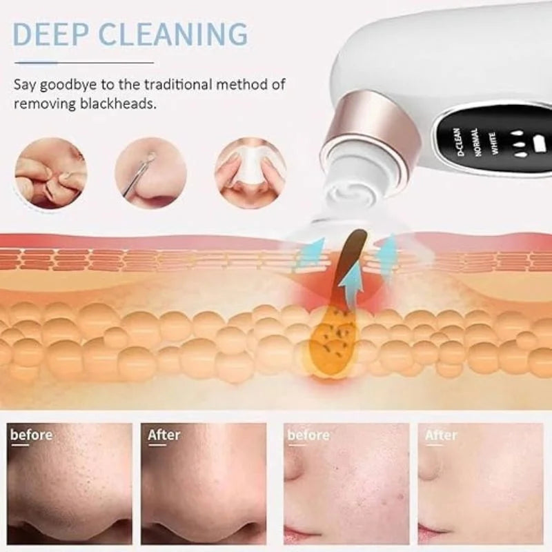 Electric Super Micro Bubble Beauty Blackhead Remover | Pore Vacuum Cleaner & Facial Deep Cleansing Device | USB Rechargeable Skin Care Tool