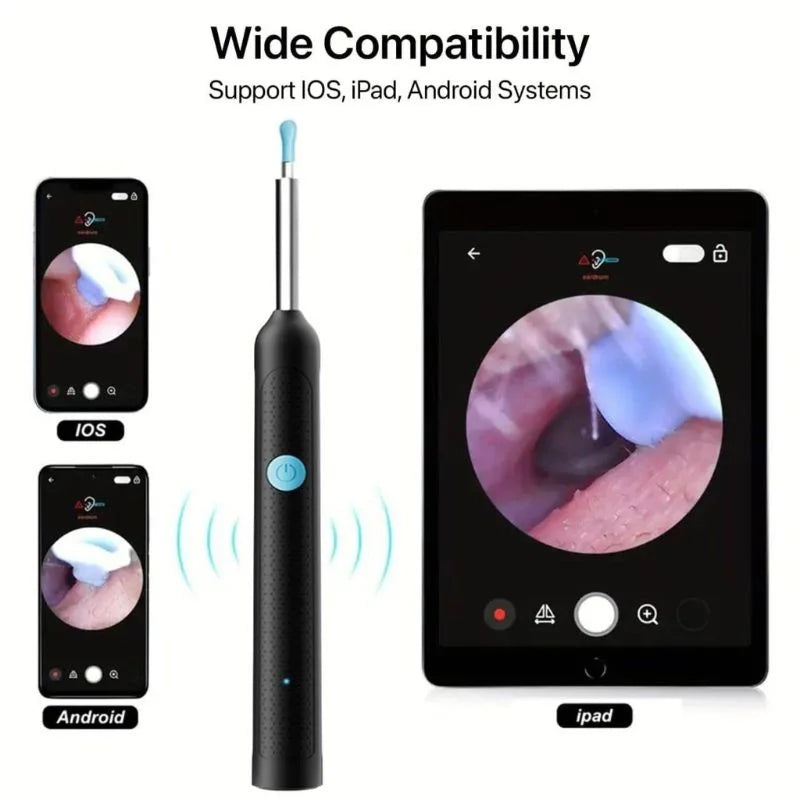 Smart Visual Ear Cleaner with 1080P HD Camera | Wireless Ear Wax Removal Otoscope | LED Ear Cleaning Tool for Android & iOS | Rechargeable & Portable